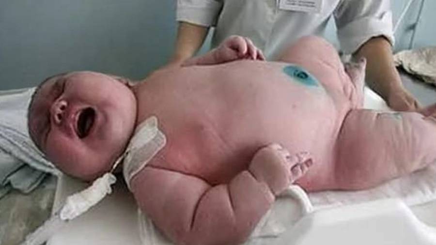 Mujer de 272 kilos tuvo un bebé de 18 kilos