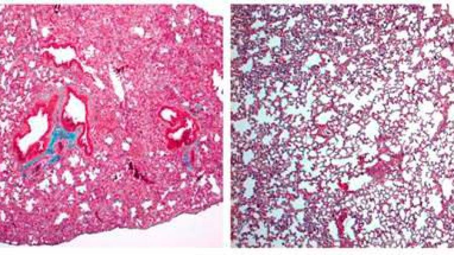 A la izquierda, pulmón de ratón con signos de fibrosis pulmonar grave. A la derecha, pulmón de ratón tratado con cortistatina, en el que el daño es mucho menor. Foto: IPBLN-CSIC