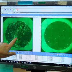 cura. Una empleada de PharmaMar muestra imágenes de una célula infectada con coronavirus, izquierda, y la misma tras tratarla con Aplidin, derecha (Madrid). Foto: Kiko Huesca