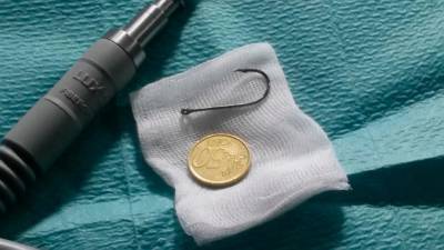 Imaxe do anzol que extraeron ao pinscher, do tamaño dunha moeda. Foto: T.V. 
