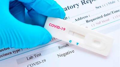 Las farmacias podrán vender test rápidos de COVID sin receta