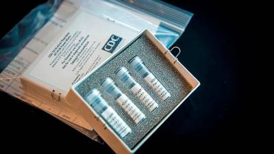 El kit de prueba de laboratorio para detectar el coronavirus en los Estados Unidos. Foto: EFE