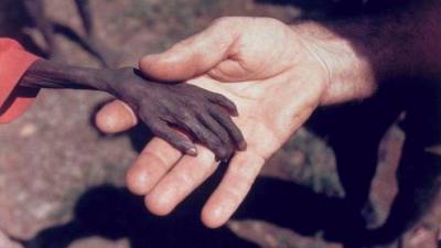 1980. Misionero toma la mano de un niño. La fotografía fue tomada en Uganda y en ella se ve como un misionero sostiene la mano de un niño desnutrido. Una foto sencilla con un gran significado, la desigualdad tan grande que existe actualmente en muchas, demasiadas poblaciones. Autor, Mike Well.
