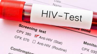 España supera 3.500 infectados por VIH al año
