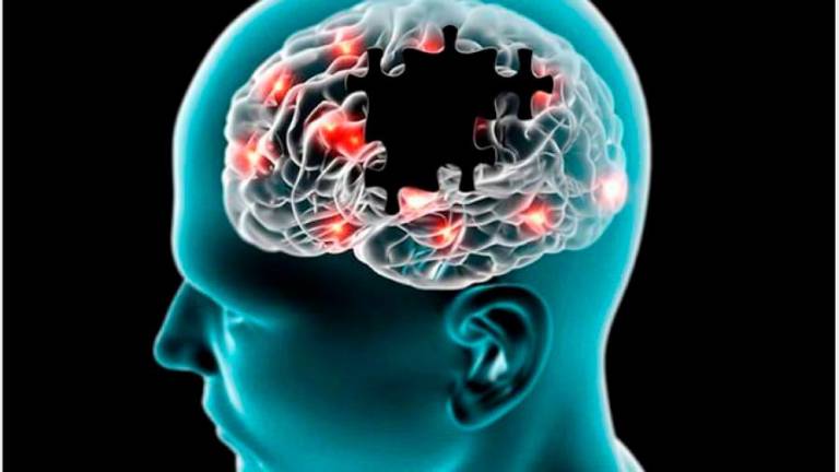 Relacionan la acumulación de una proteína en el cerebro con el Alzheimer