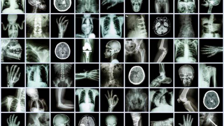 Imagen de distintas radiografías