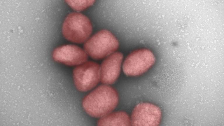 PARTÍCULAS del virus de la viruela del mono teñidas de rojo