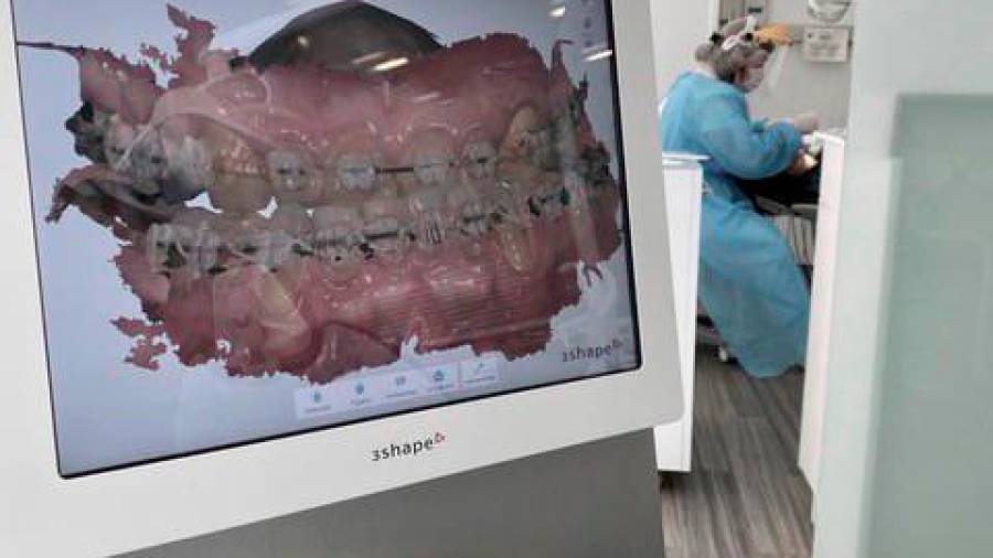 Tratamientos más cortos y estéticos de ortodoncia gracias a la tecnología 3D