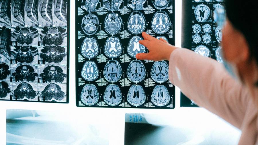 Imágenes de una tomografía cerebral. Foto Pexels.