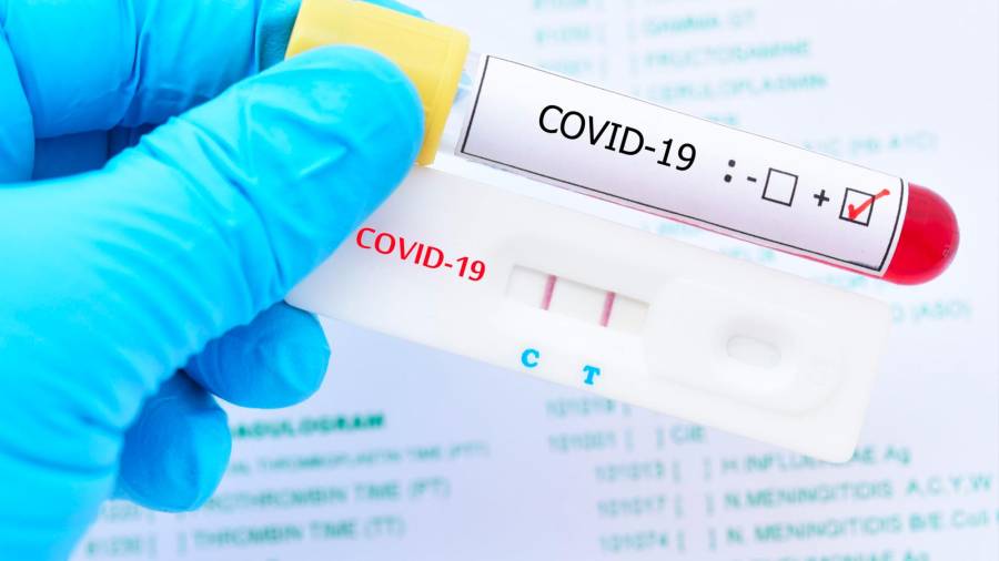 Sanidad recomienda a CCAA tener un ‘stock’ suficiente de pruebas Covid-19 para cubrir necesidades de dos meses