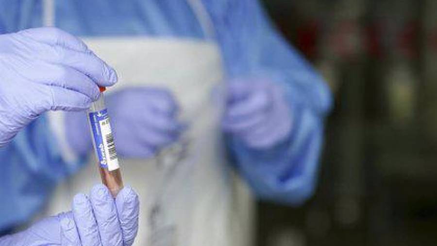 Na foto de arquivo, un sanitario protexido con luvas sostén unha mostra para realizar unha análise PCR. EUROPA PRESS