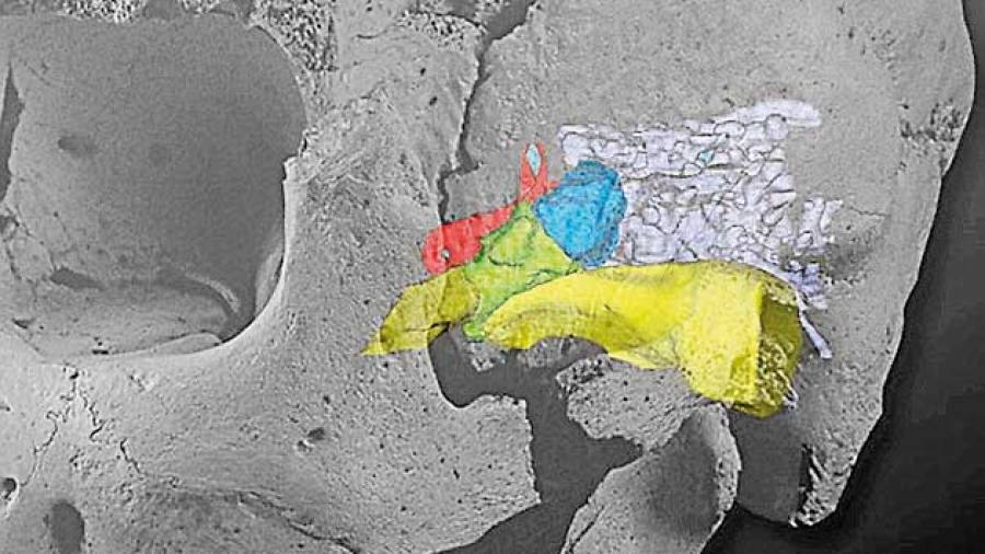 Hallazgos de Atapuerca válidos frente a la sordera