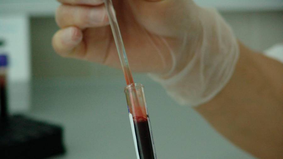 Un sanitrario con una muestra de sangre
