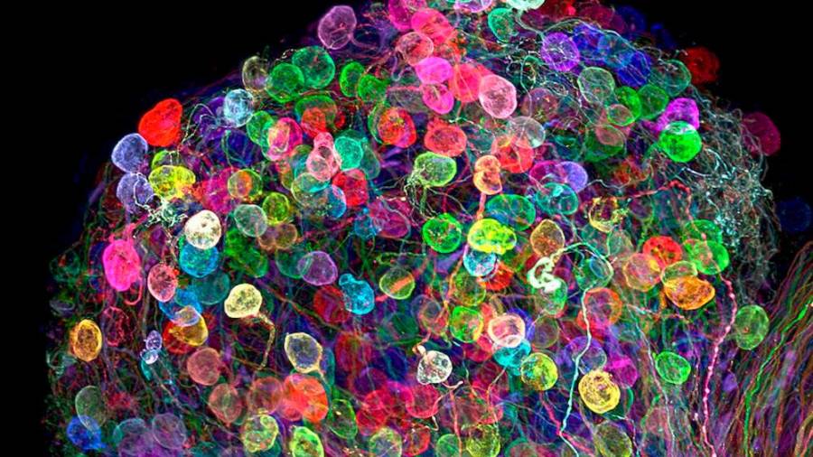 Axones marcados individualmente en un ganglio ciliar embrionario. Autor: Ryo Egawa de la universidad de Nagoya de Japón. (Fuente, www.muyinteresante.es).