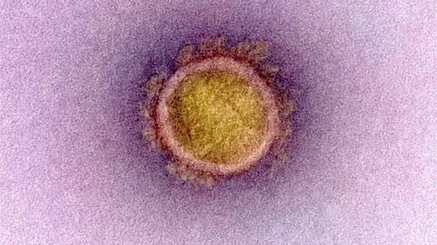 Imagen de un coronavirus visto en una micrografía coloreada. Se puede apreciar perfectamente la “corona” que lo rodea. (Fuente, www.nationalgeographic.com)