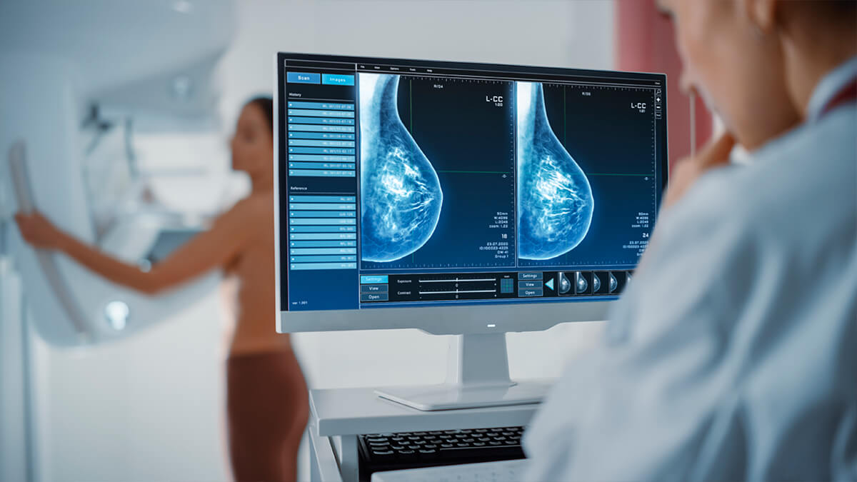Cuando el cáncer de mama no se cura: el estigma de las pacientes con metástasis